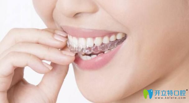 黃淘醫(yī)生科普：隱形矯正有哪些優(yōu)勢(shì)
