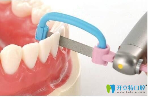 請(qǐng)看：正畸中鄰面去釉對(duì)牙齒有危害嗎？