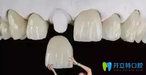 解答：做了全瓷牙基牙爛掉的概率高嗎？