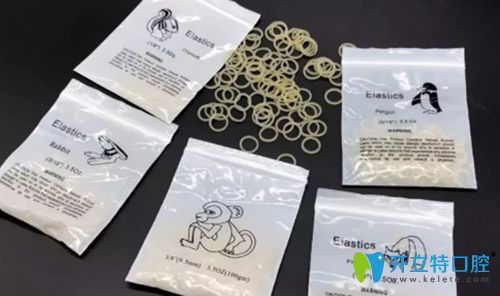 正畸中橡皮筋的作用不容小覷,它是整牙收縫階段的必要步驟!