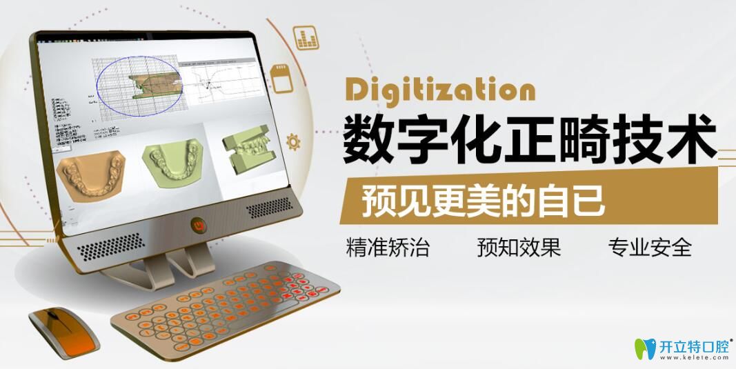 中山好民生口腔矯正特色技術數(shù)字化矯正技術