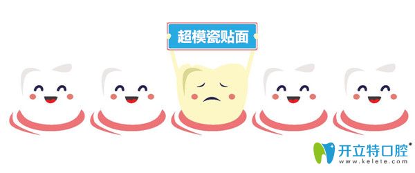 超模瓷貼片好不好？解析超模瓷貼面和全瓷貼面的區(qū)別