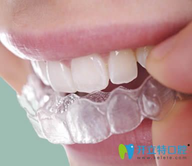 韋飛科普隱形牙齒矯正有哪些優(yōu)點(diǎn) 韋飛科普隱形牙齒矯正有哪些優(yōu)點(diǎn)