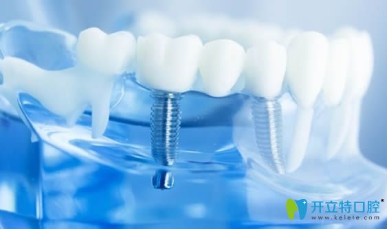 原來(lái)有種植牙可以做牙齒矯正，但因人而異！
