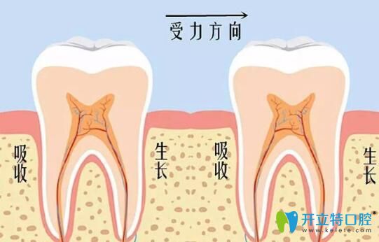 維樂(lè)口腔李書(shū)琴醫(yī)生告訴你：牙齒矯正會(huì)導(dǎo)致牙齒松動(dòng)嗎