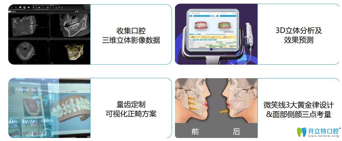 深圳弘和口腔的牙齒矯正的先進(jìn)技術(shù)