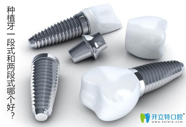種植牙一段式和兩段式哪個好，不同種植體的區(qū)別在哪？