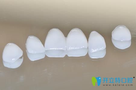 南昌輝煌口腔錢<!--<i data=20240703-sp></i>-->介紹牙齒貼面的優(yōu)勢(shì)