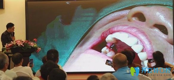 天津中諾口腔趙振宇院長(zhǎng)案例分享