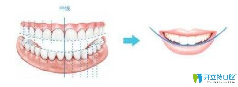 李帥指出珠海愛思特矯正的優(yōu)勢(shì)有這些