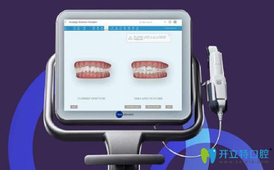 廣州曙光口腔itero口掃