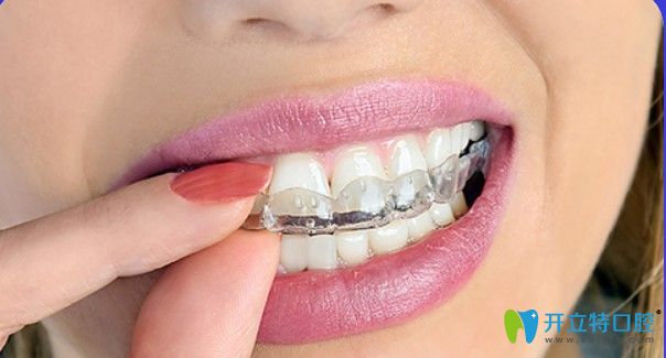 北京維樂(lè)口腔隱適美隱形矯正