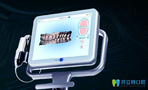 福州維樂口腔iTero口掃