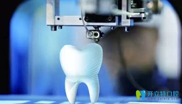數(shù)字化3d導(dǎo)板全程種植牙特色
