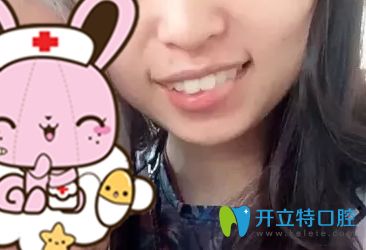 牙齒矯正后不戴保持器反彈的牙齒