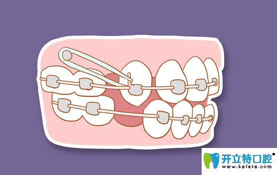 寧波恒美口腔王金總監(jiān)的正畸優(yōu)勢(shì)