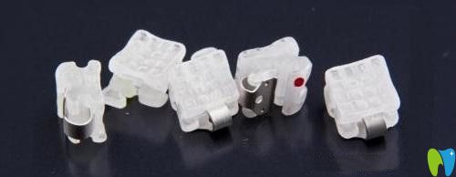 半隱形陶瓷托槽牙齒矯正的優(yōu)缺點(diǎn)