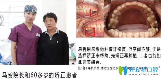 鄭州拜博口腔馬賀院長(zhǎng)和60多歲的矯正者合影