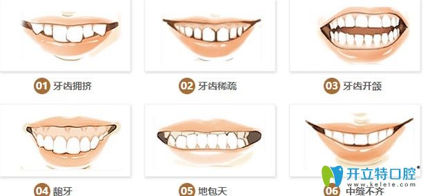 牙齒各類情況圖示