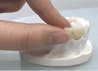 做烤瓷牙疼嗎？網(wǎng)呼千萬(wàn)不要做烤瓷牙是因?yàn)槟パ捞蹎幔? border=