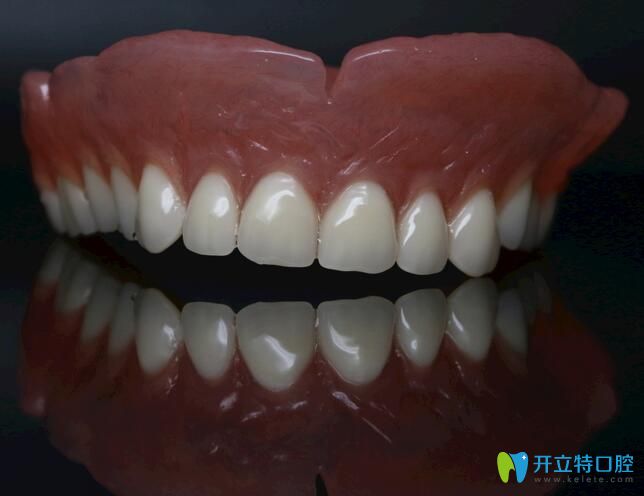 昆明尚愛韓美口腔孫亞杰介紹全口活動義齒的優(yōu)缺點