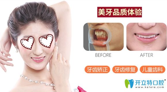 沈陽百嘉麗口腔牙齒矯正真人效果圖