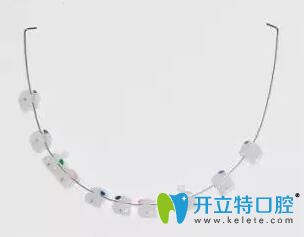 我<!--<i data=20240703-sp></i>-->口腔戴的半隱形陶瓷托槽 我<!--<i data=20240703-sp></i>-->口腔戴的半隱形陶瓷托槽