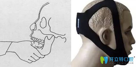 顳頜關(guān)節(jié)復(fù)位后要注意后續(xù)治療