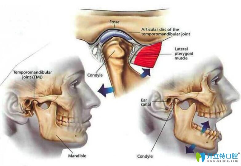 顳下頜關節(jié)紊亂能自愈嗎