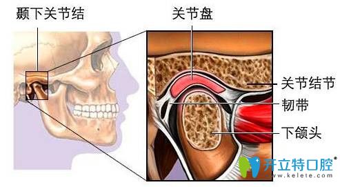 顳下頜關(guān)節(jié)紊亂能整牙嗎？正畸會(huì)不會(huì)導(dǎo)致顳頜關(guān)節(jié)紊亂？