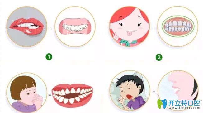 影響頜面發(fā)育的一些舉動圖示