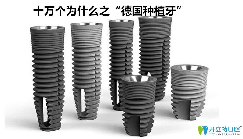德國(guó)種植牙品牌及價(jià)格是多少?看完再說德國(guó)植體什么牌子好
