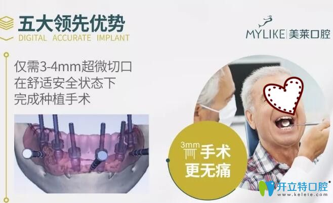 深圳美萊口腔3D顯微精準(zhǔn)種植牙5大優(yōu)勢(shì)