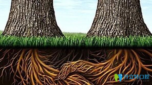 牙槽骨缺失種牙前要先植骨粉 牙槽骨缺失種牙前要先植骨粉