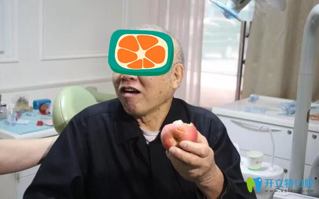 薛啟明半口種植牙術(shù)后效果圖