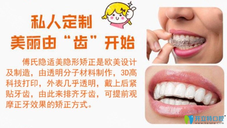 傅氏口腔門診隱適美矯正優(yōu)勢