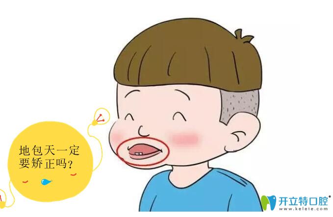 牙齒反合是不是一定要矯正