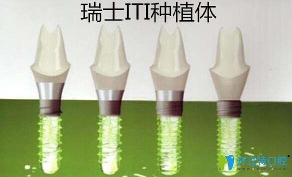 瑞士ITI種植體