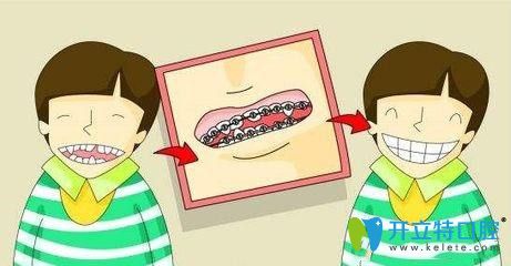 孩子牙齒矯正的圖片 孩子牙齒矯正的圖片