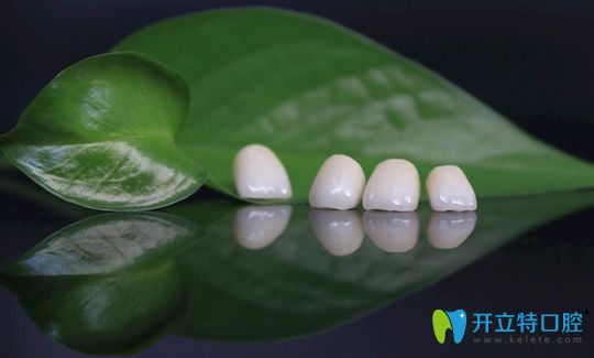 鈀金烤瓷牙和全瓷牙選哪個(gè)更好呢