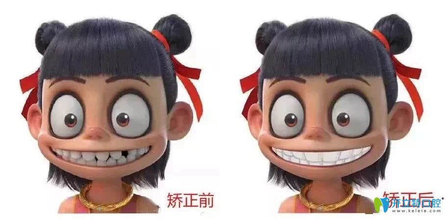 快看深圳韋博口腔暑期特惠活動,學(xué)生牙齒矯正價格才5500元起