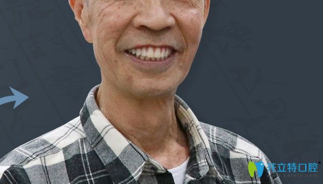 郭老全口種植牙效果照片