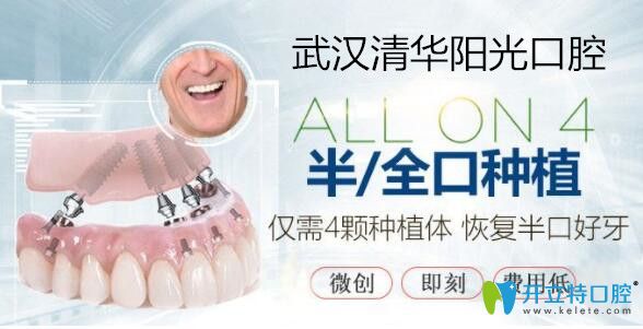 武漢清華陽光口腔ALLON4種植牙