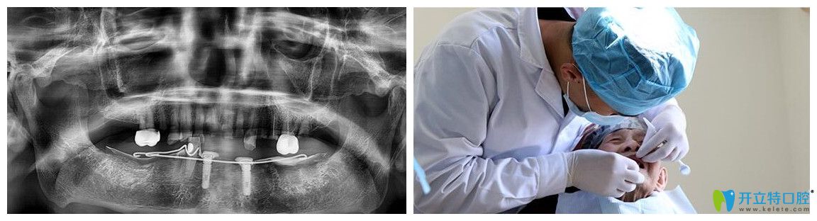 韓老拍CT和醫(yī)生檢查的圖片