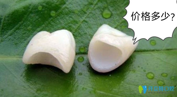仿生冠牙齒多少錢(qián)呢