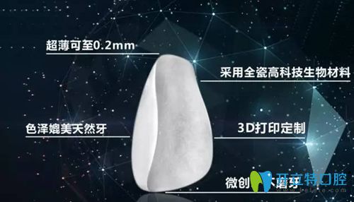 牙貼面優(yōu)勢宣傳圖