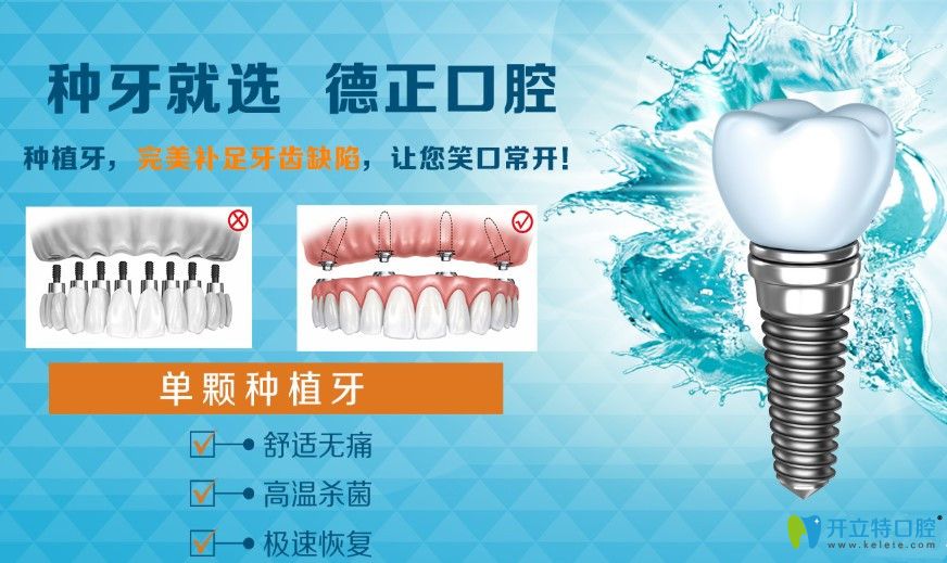 鄭州德正口腔單顆牙種植優(yōu)勢