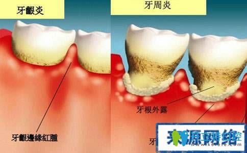 姬金平醫(yī)生教我們?nèi)绾闻袛嘧约菏欠裼醒乐苎? alt=