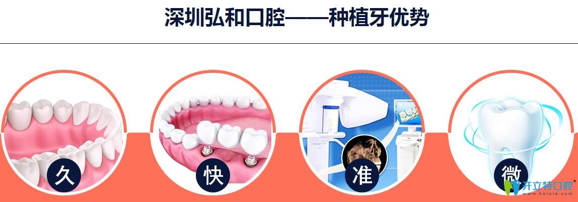 深圳弘和口腔種植牙優(yōu)勢