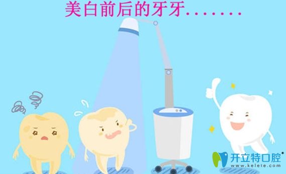 彩光美白牙齒和冷光美白牙齒的區(qū)別